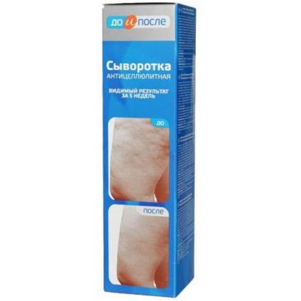 ДО И ПОСЛЕ СЫВОРОТКА АНТИЦЕЛЛЮЛИТН. 130 мл