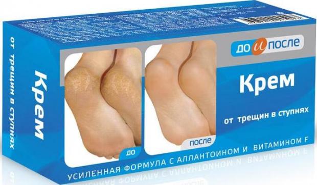 ДО И ПОСЛЕ ОТ ТРЕЩИН В СТУПНЯХ КРЕМ ДЛЯ НОГ 150 мл