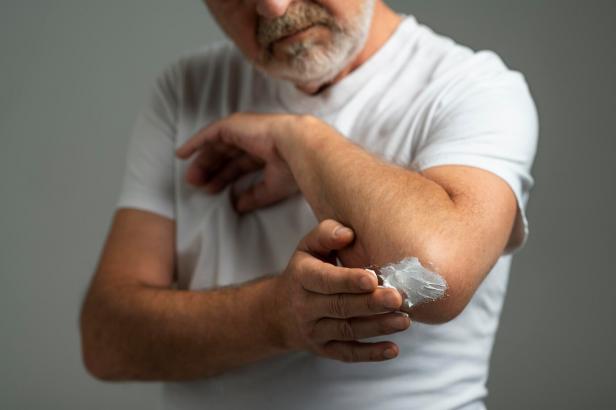 Кремы и мази при ушибах, растяжениях и синяках