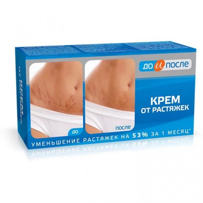 ДО И ПОСЛЕ КРЕМ ДЛЯ ТЕЛА ОТ РАСТЯЖЕК 100 мл