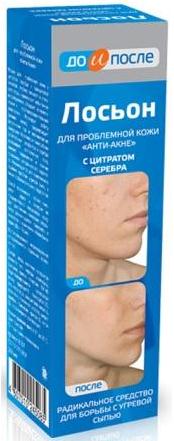 ДО И ПОСЛЕ АНТИ-АКНЕ ЛОСЬОН ДЛЯ ЛИЦА 200 мл для проблемной кожи